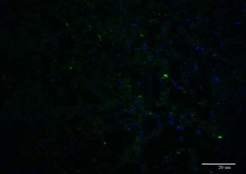 3: DAPI a Cy5