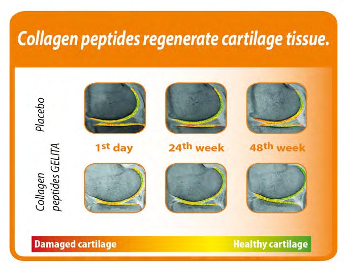 collagen hydrolysate: a pilot randomized controlled trial, McAlindon 2011 18 23.