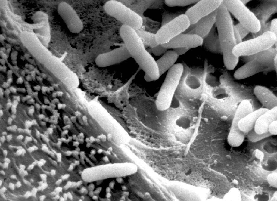 Děkuji za pozornost Pseudomonas aeruginosa v elektronovém