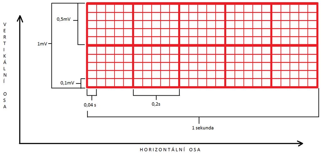 1. V1-4. mezižebří vpravo od sterna 2. V2-4. mezižebří vlevo od sterna 3. V3 - mezi V2 a V4 4. V4-5. mezižebří vlevo v medioklavikulární čáře 5. V5 - ve výši V4 vlevo v přední axilární čáře 6.