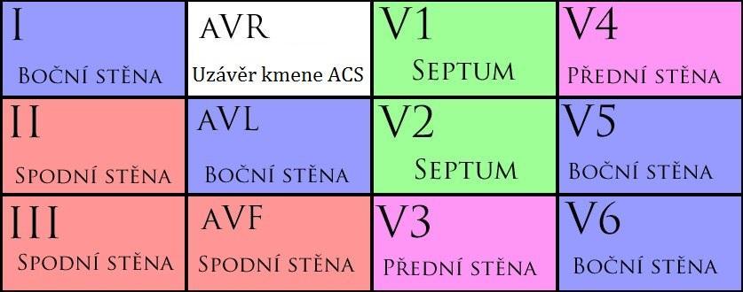 Akutní infarkt myokardu s elevacemi ST úseku se podle postižené stěny srdečního svalu propaguje do svodů, které snímají nekrotickou srdeční stěnu a může se propagovat i do svodů sousedících s těmito