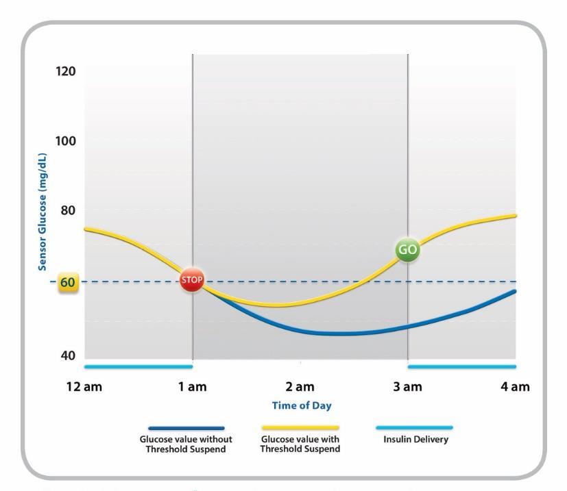 Low Glucose Suspend Zásadní komplikace - zpoždění Zpoždění CGM Zpoždění akce insulinu Aktuálně používané režimy: Pouze ochrana před hypoglykémií Insulin lze pouze dodat nebo dodávku zastavit Low