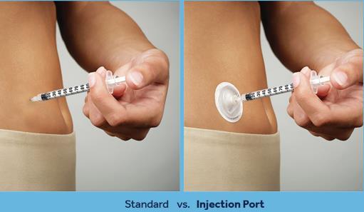 I-port (Medtronic)