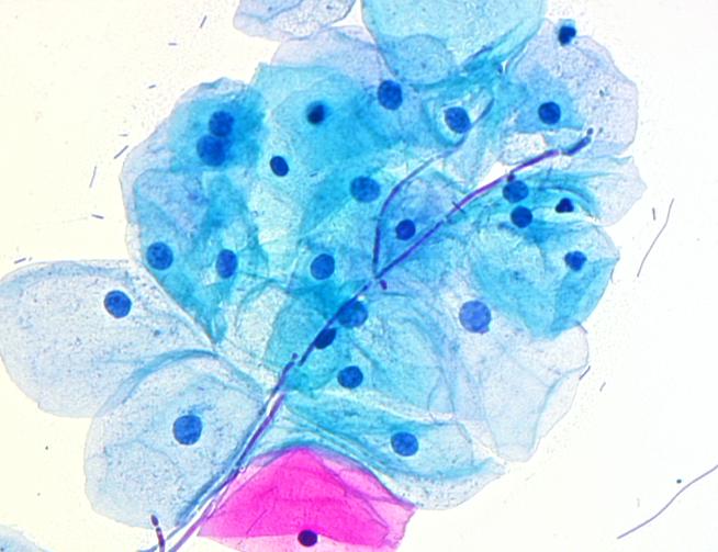 Současné možnosti certifikace cytotechnologů a Národní program screeningu karcinomu děložního