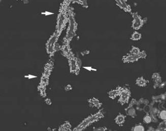 atd. v protoplastu, popř. v buněčné stěně často rozpustné ve vodě produkty fotosyntézy dodávané fotobiontem mykobiontovi: sinice glukóza zelené řasy tzv.