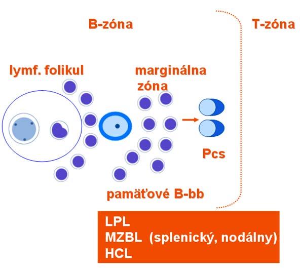 nádorová transformácia MZ buniek chýba genetický marker, blok mutácií (IgVH u/m) rizikové faktory vzniku: a) infekcia (napr. HCV) - nepriamo, cez aktiváciu B-imúnnej reakcie (antivírus.