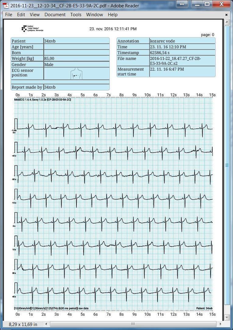 EKG reporty s označenými