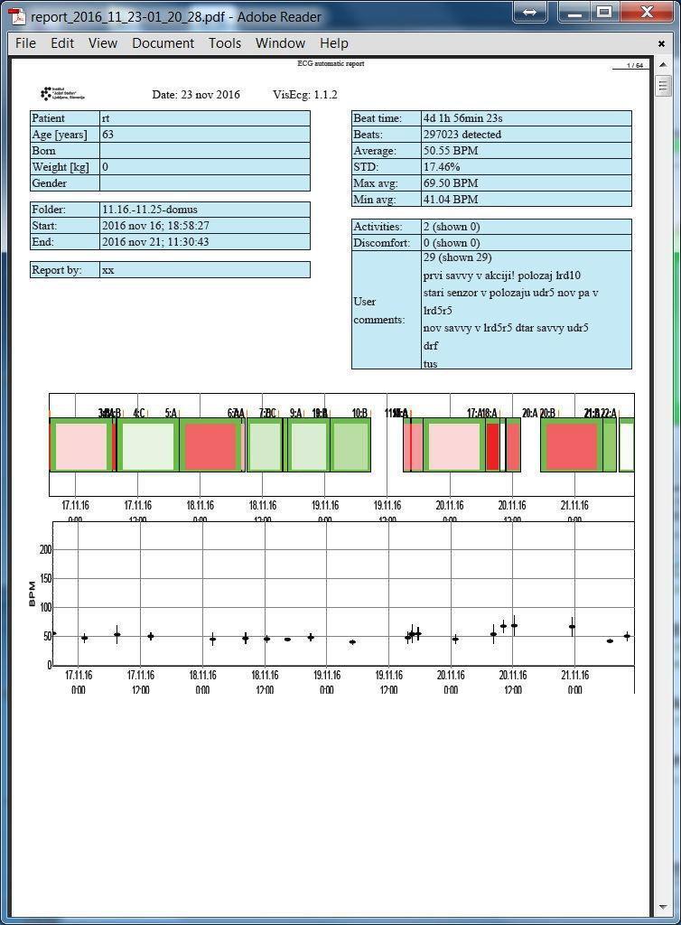 EKG report veškerých