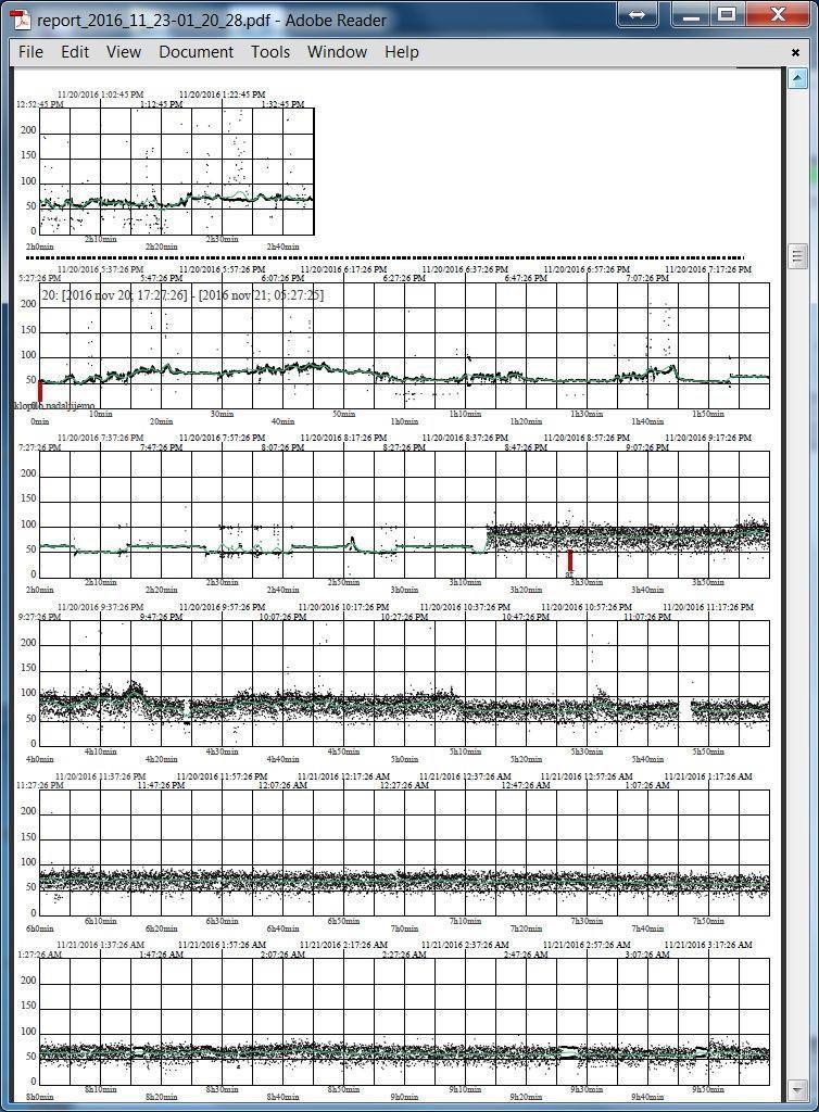 PDF EKG report veškerých naměřených dat po 1 hodině BPM na