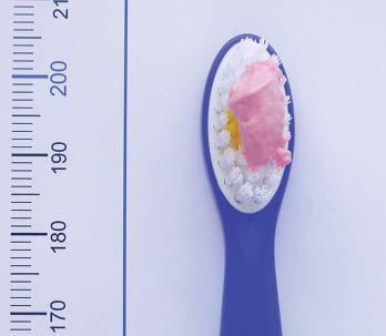 RIZIKA I. Problémy s příjmem potravy a kariogenní dieta II. III. IV. Aktivní ortodontická terapie Vysoká hladina kariogenních bakterií Špatná a nepravidelná hygiena dutiny ústní V.