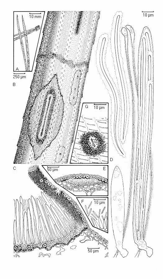 Obr. 3: Lophodermium conigenum Příloha 9.1.1. A. Vzhled na jehlicích. B. Hysterothecium, pyknidy a zonální linie (pod mikroskopem). C.