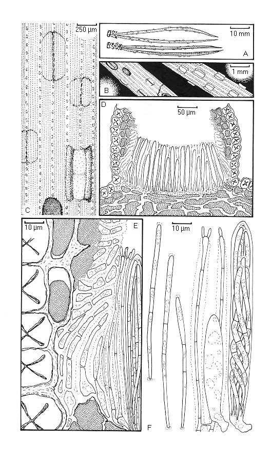 Obr. 4: Cyclaneusma minus Příloha č. 9.1.1. A. Vzhled na jehlicích. B. Plodnice pod lupou. C. Plodnice pod mikroskopem. D.