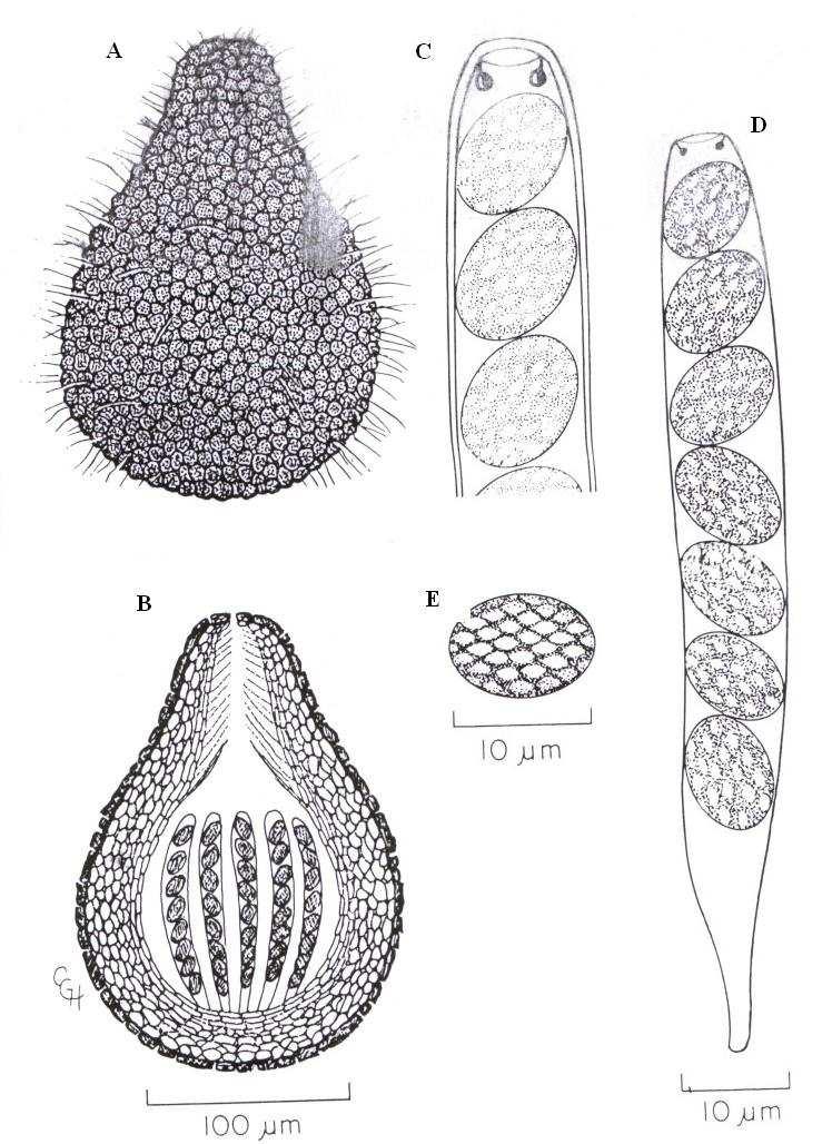 Obr. 8: Gelasinospora sp. Příloha č. 9.1.1. A. Askoma. B.