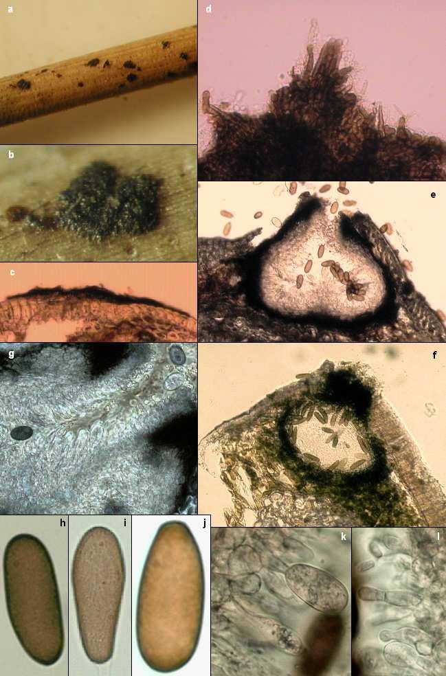 Příloha č. 9.1.2. Obr. 6: Leptothyrium sp.: a, b vzhled na jehlici, c - řez konidimatem, d povrch konidiomatu.