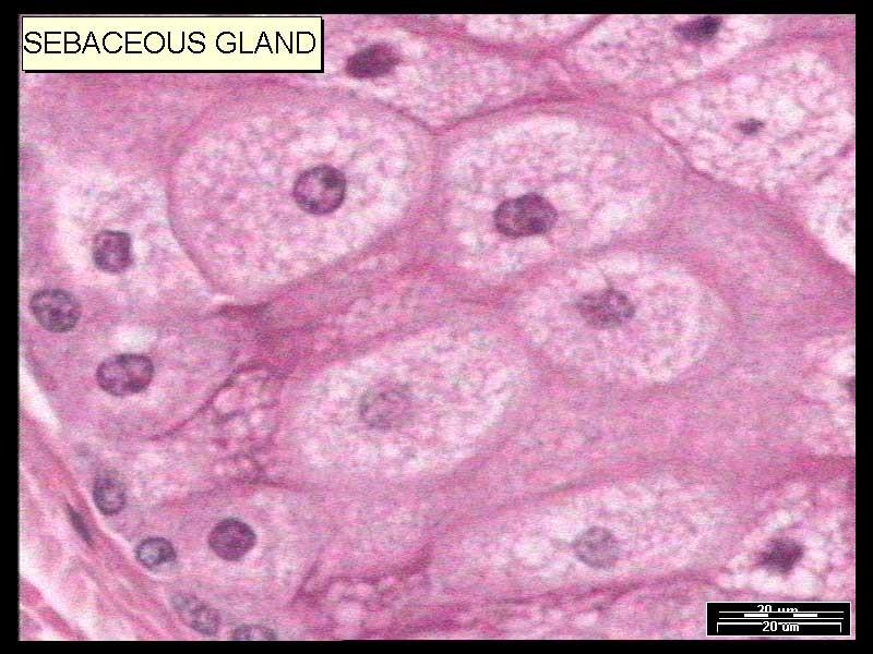 Gl. sebaceae (HE) Pyknotic nucleus