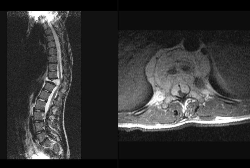 MRI 15.