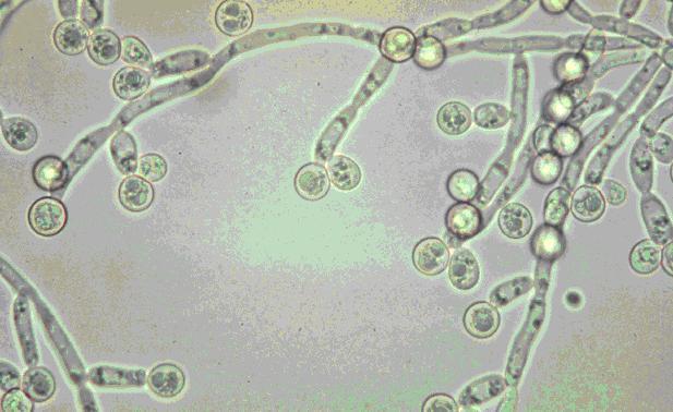 Mykologické desatero Kandidy a echinokandiny Laboratorní diagnostika MUDr.