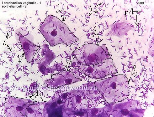Normální mikroflóra: epitelie, laktobacily (Döderleinův bacil) Giemsa za normální lze považovat i