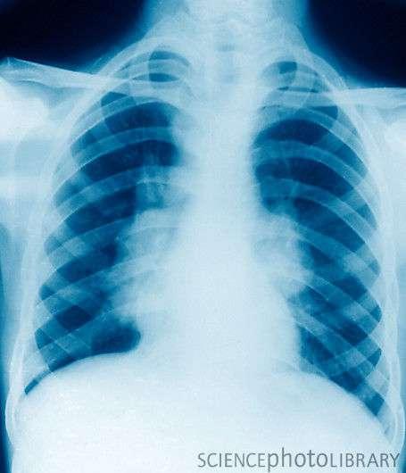 Nádcha Laryngitída Faryngitída Bronchitída Chrípka Tuberkulóza Zápal pľúc Rakovina