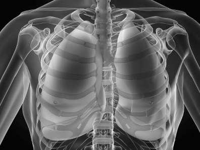 pohrudnicovej dutine) pneumothorax atmosférický vzduch sa dostane do pohrudnicovej dutiny =