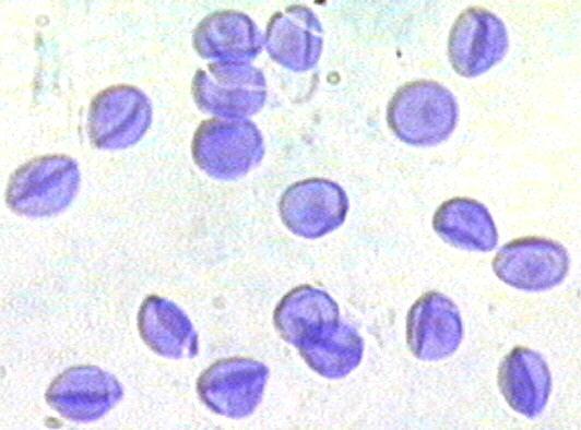 Třída Pneumocystidomycetes: opět monotypická skupina s jediným rodem Pneumocystis, kerý byl v minulosti povaţován za prvoka (Protozoa). První popis ve Francii 1912 z krysích plic. Nemyceliální stélka.