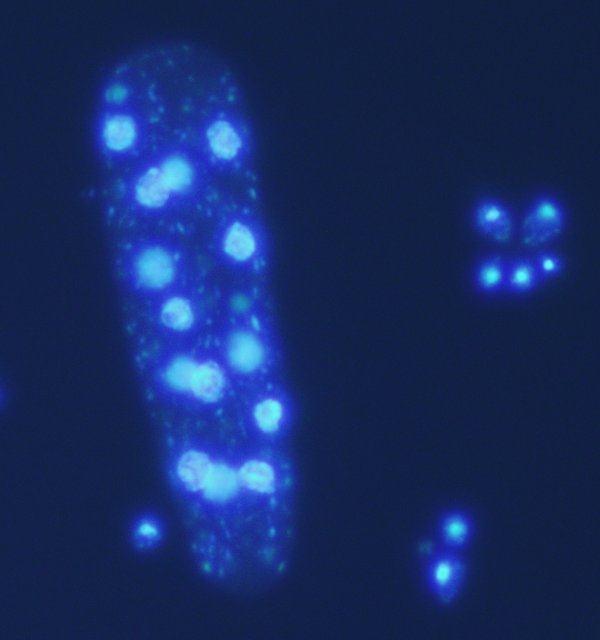 Gilg (1924) 2 rody (Dipodascus a Galactomyces), 16 druhů Vláknité septované mycelium