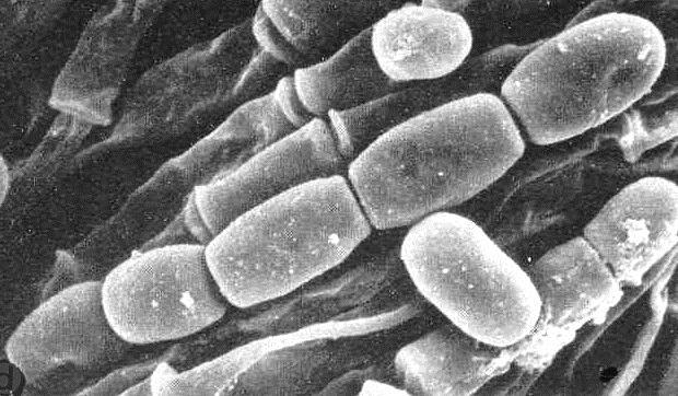 Geotrichum Link 1809 anamorfa rodů Dipodascus a Galactomyces, 23 druhů, geotrichosis onemocnění způsosobené druhy rodu Geotrichum (bronchiální, pulmonární i