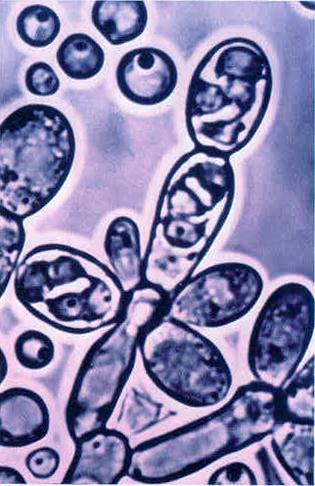 Saccharomyces