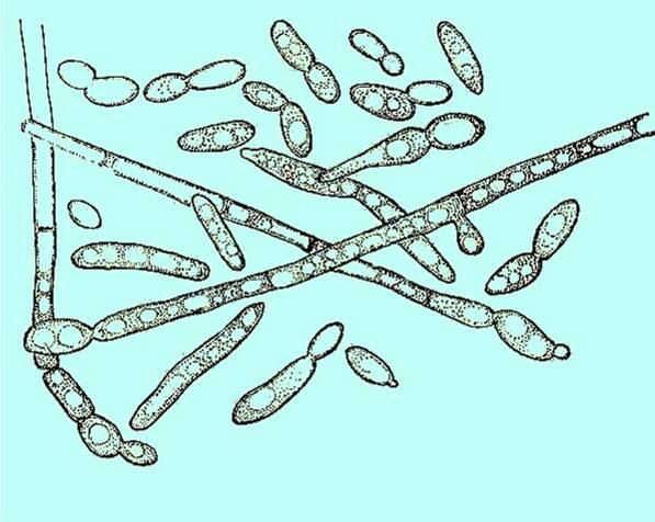 Saccharomycetes přehled čeledí a rodů Řád