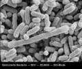 a) b) Obr.4 bakterie způsobující zkázu tuků Escherichia coli ( a ) a bakterie napadající vejce Salmonella ( b ) ( http://www.szpi.gov.cz/cze/aktuality/list.asp?page=9&cat=2176