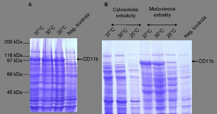 Výsledky Obr. 25: Produkce podjednotky CD11b SP s C-koncovou histidinovou kotvou. A) SDS elektroforesa celobuněčných lysátů; B) SDS-PAGE cytosolu a močovinových extraktů v 7,5% polyakrylamidovém gelu.