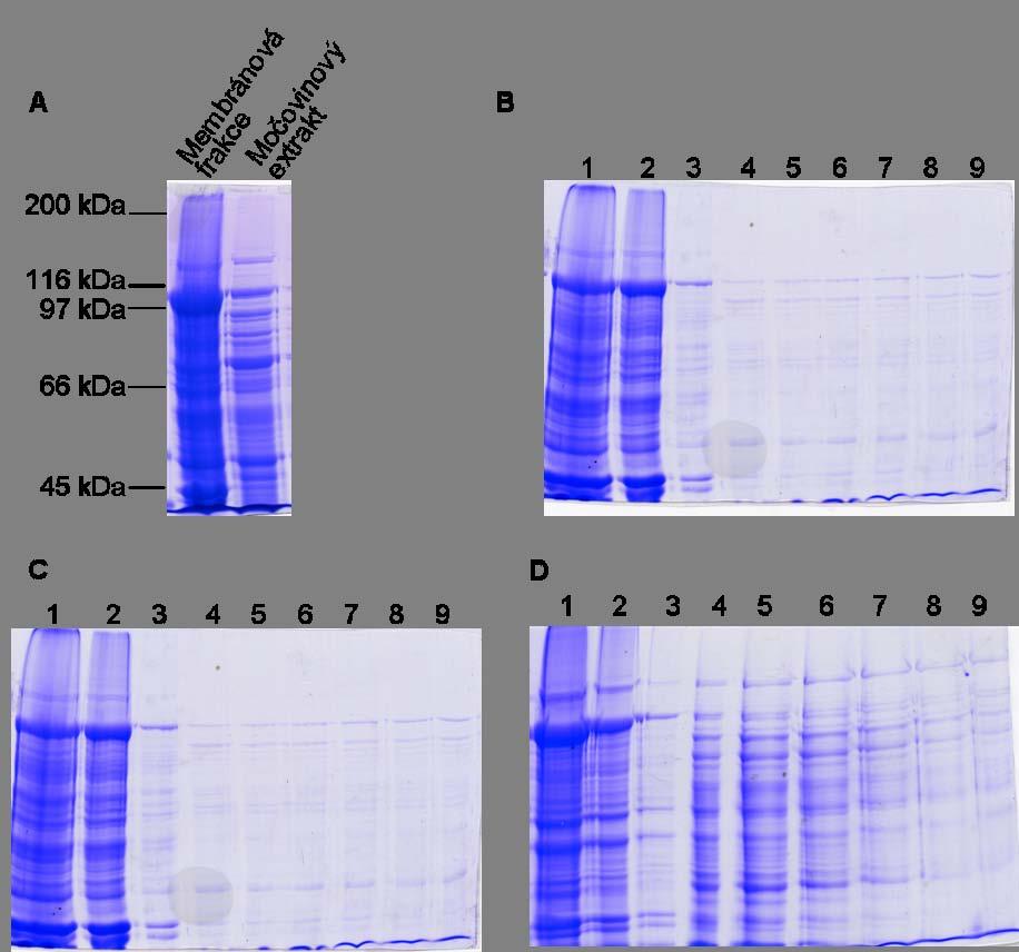 Výsledky Obr. 26: Purifikace extracelulární domény podjednotky CD11b fúzované s C-koncovou histidinovou kotvou. A) Analysa membránové frakce a močovinového extraktu (7,5 % SDS-PAGE).
