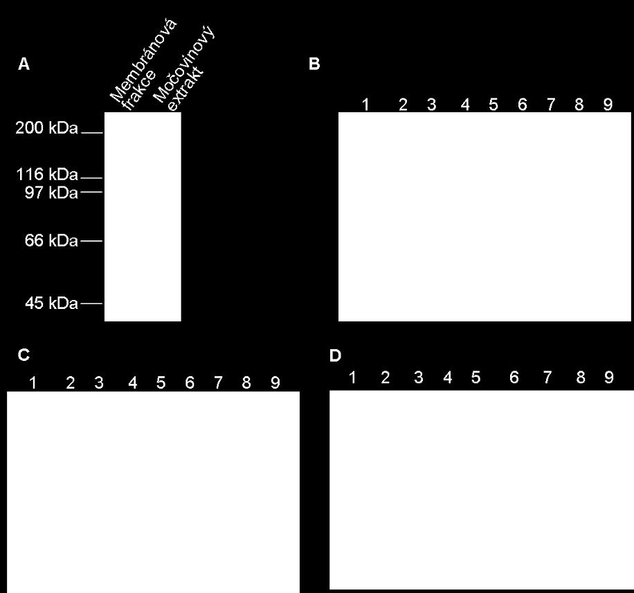 20 (D). Na 7,5 % polyakrylamidový gel s SDS byly vzorky naneseny vždy v tomto pořadí: 1. membránová frakce; 2. nezachycená frakce; 3. promytí; 4.-9. frakce po eluci.
