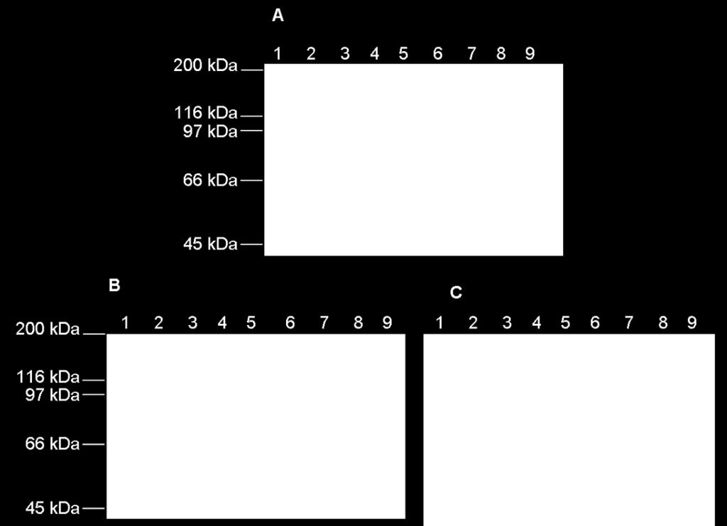 (B) nebo TUMC pufru s 1 % Tweenem 20 (C). Na 7,5 % polyakrylamidový gel s SDS byly vzorky naneseny vždy v tomto pořadí: 1. membránová frakce; 2. nezachycená frakce; 3. promytí; 4.-9. frakce po eluci.