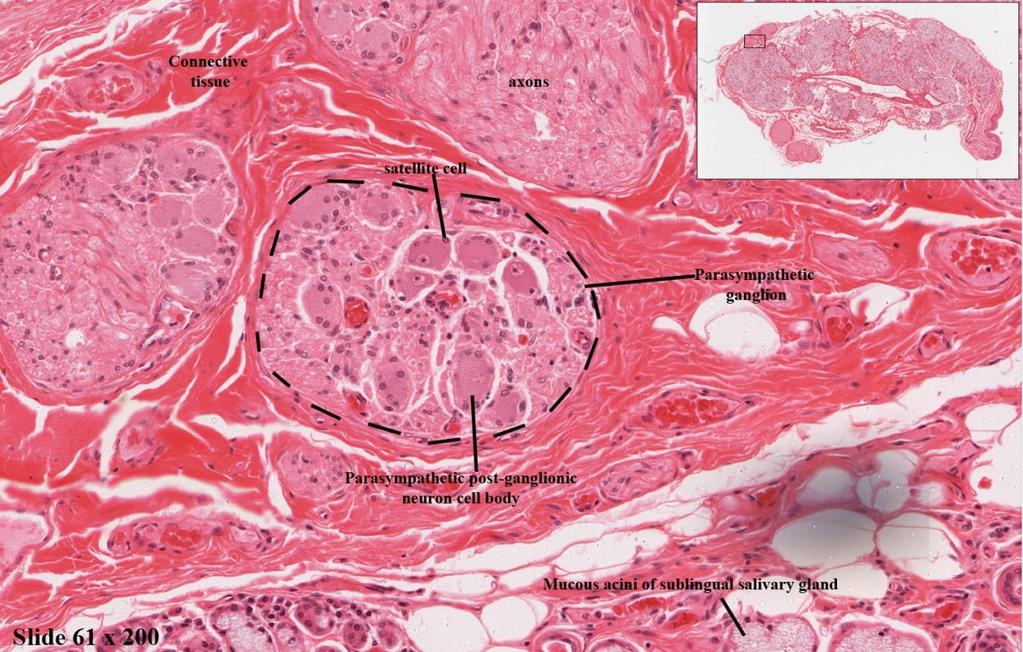 obsahuje multipolární neurony (jádro periferně a kulaté) - lipofuscin - nekompletní vrstva