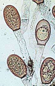 rhizomycelium eukarpická polycentrická stélka