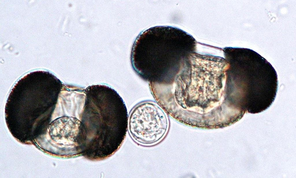 zoosporangium tlustostěnná odpočívající sporangia vyprazdňující se zoosporangium pylová zrna