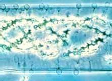 Rhizophydium granulosporum Chytridiales, parazitující na ţivé buňce zelené řasy rodu