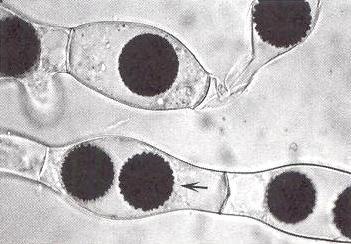 ve stélce druhu Allomyces javanicus