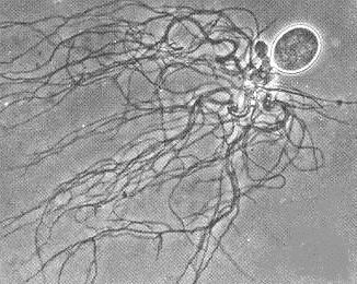 sporangia a rhizoidy