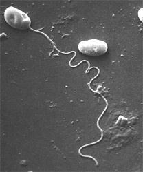 Nosema tractabile, microsporidian spore with ejected polar filament transformed into a