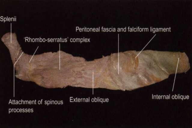 Obrázek 5: Myofasciální anatomické vztahy 23 Na obrázku č. 5 je znázorněna provázanost svalů (zde: m.