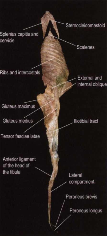 , gluteus maximus, gluteus medius, tensor fascie latae, iliotibiální trakt, přední vaz hlavičky fibuly, laterální kompartment, m. peroneus brevis, m. peroneus longus.