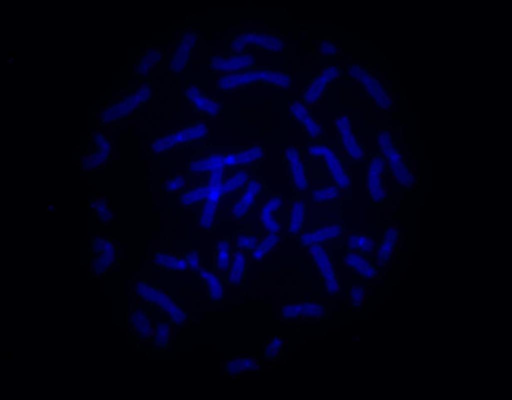 FISH = fluorescenční in situ hybridizace Umožňuje detekci balancovaných i nebalancovaných změn v interfázních buňkách i v mitózách OLG FN Brno 1969 Parduová a Gall