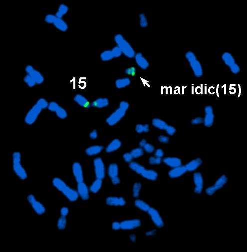 Klinická cytogenetika Identifikace markerových chromozomů supernumerary marker chromosome, markerový chromozom či jen marker; je to malý nadbytečný