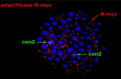 1. Spektrum molekulárně cytogenetických vyšetření Onkogenetika kultivované buňky KD, nátěry KD, otisky nádorů, DNA z KD a nádorů detekce prognosticky významných specifických CHA u některých