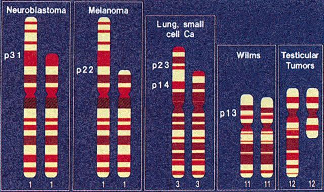 Onkogenetika Ztráta části chromozomu je častou příčinou různých typů solidních nádorů