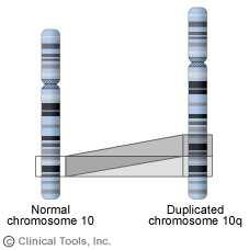 Onkogenetika Strukturní CHA : Duplikace celé chromozomy nebo jejích části časté sekundární změny v nádorových