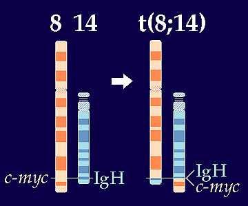 Onkogenetika Důsledky chromozómových aberací v procesu karcinogeneze; Translokace spojené s aktivací protoonkogenů t(8;14) u ALL a lymfomů c-myc onkogen z 8q24 přesunut do oblasti genu pro těžký