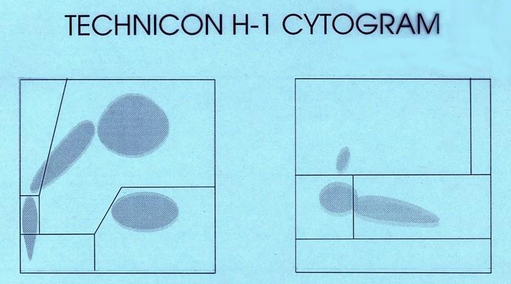 myeloperoxidázy leukocytů